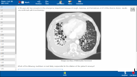 Pulmonary physiology.pdf